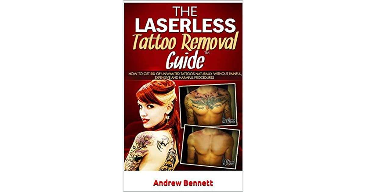 The Laserless Tattoo Removal Guide: How to get rid of ...